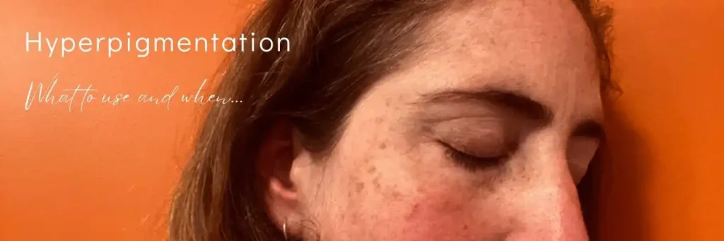 Hyperpigmentation