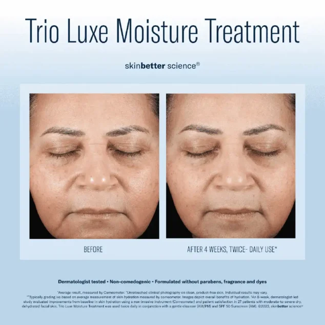 SkinBetter Science Trio Luxe Moisture Treatment