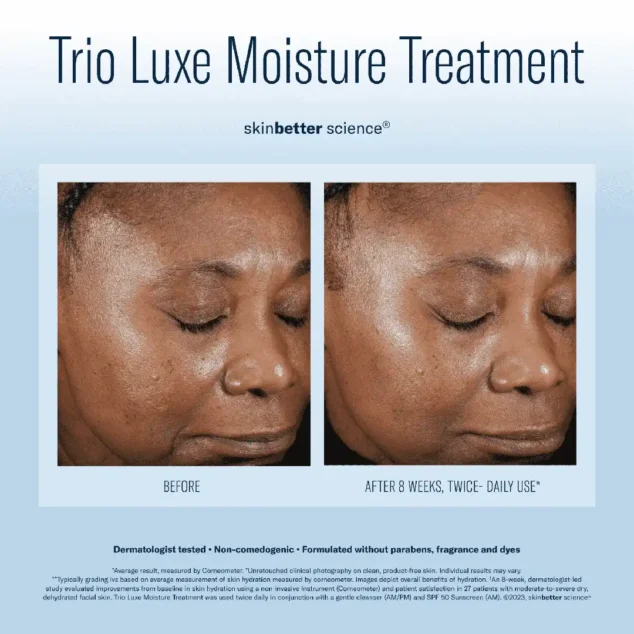 SkinBetter Science Trio Luxe Moisture Treatment